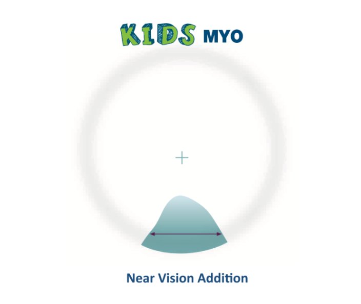 Kids MYO lens — near-vision addition zone for myopia control